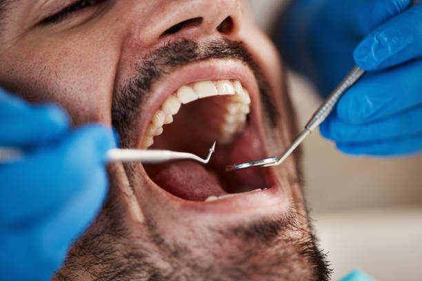 Best Emergency Dental Surgery in Fort Oglethorpe, GA